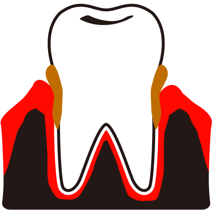 View All Images-1 - Dental Plaque Clip Art (640x480)