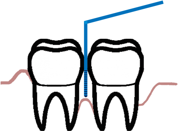The Disease Of The Supporting Tissues Of Teeth Generates - Periodontology (960x520)