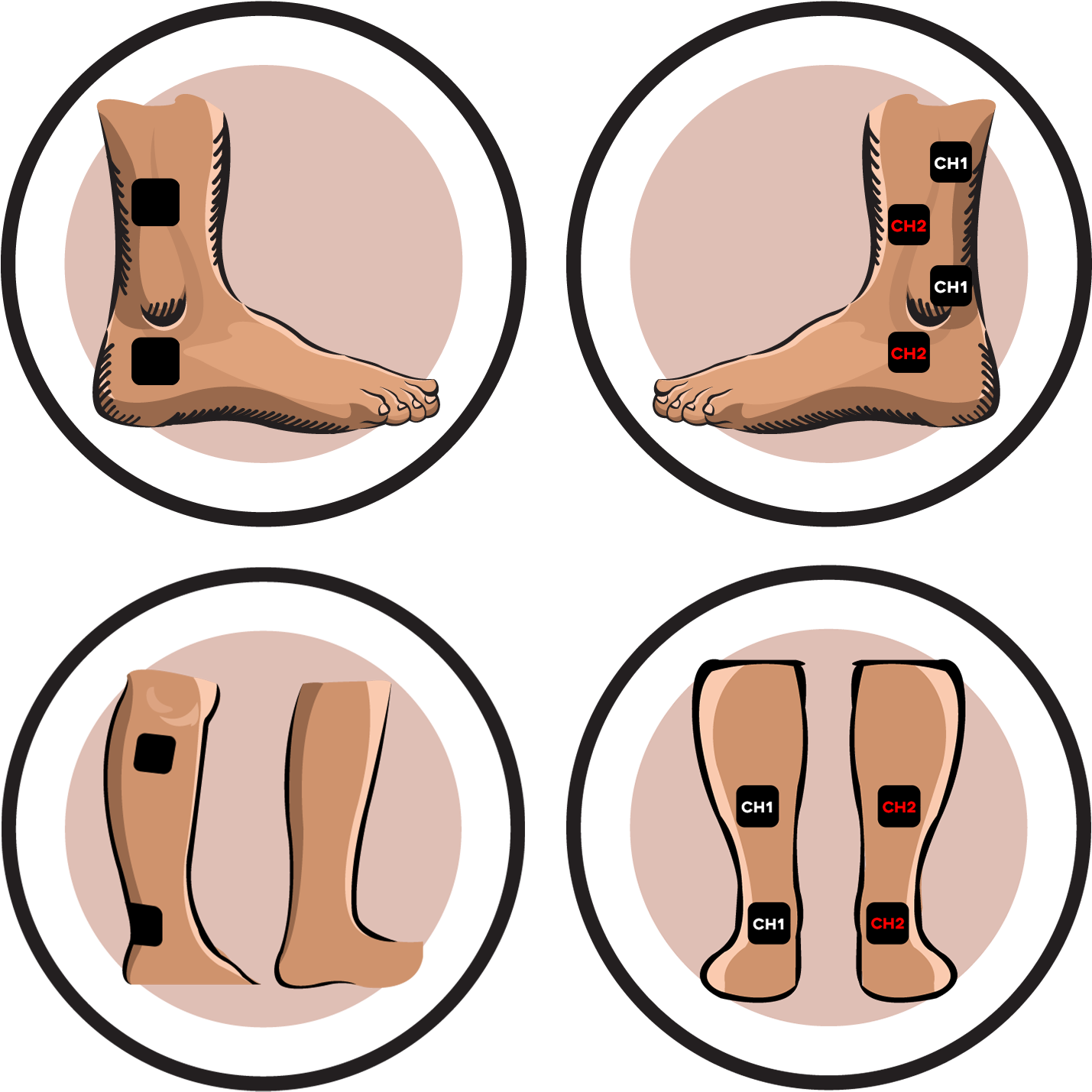 - Ireliev - Ankle Tens Unit Placement (1470x1470)