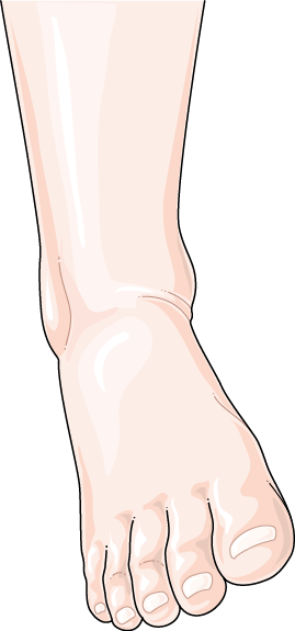 Download The Image - Sprained Ankle (269x575)