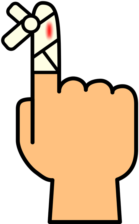 Cancelled Due To Injury - Cancelled Due To Injury (798x800)