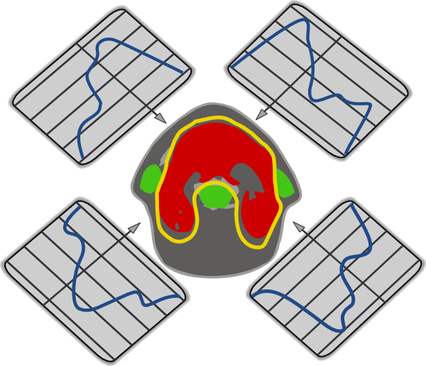 Mri 20clipart - Imrt (2400x2065)