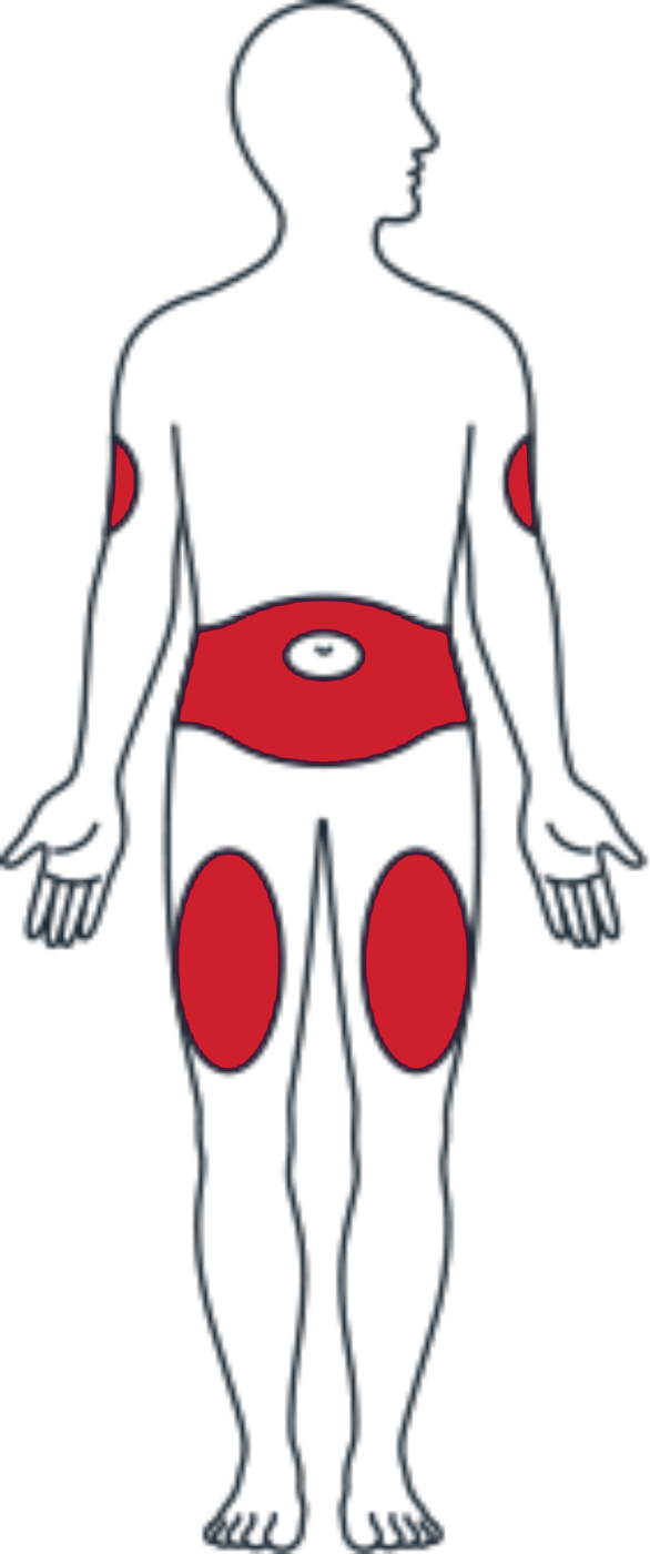 Front Side Appropriate Injection Sites - Arm (586x1400)