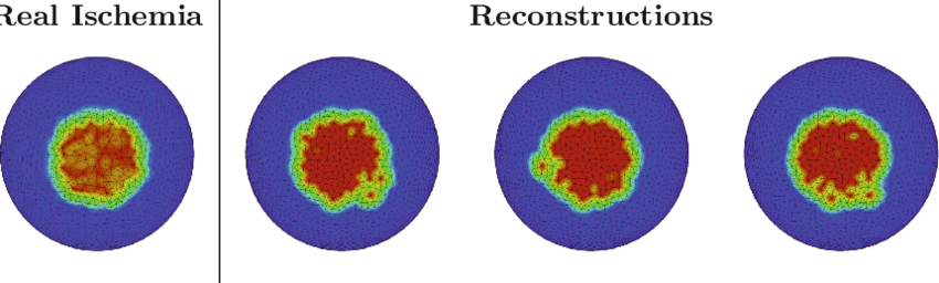 Reconstruction Of A Ischemic Area Considering Different - Circle (850x256)