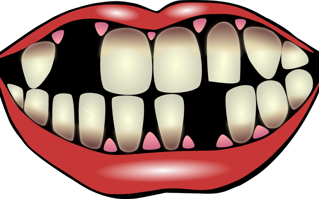 9 Factors For Losing Your Teeth - Bright Smile Clipart (1080x675)