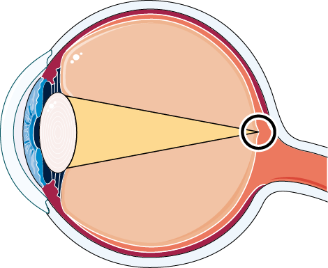 Normal Eye - Structure De L Oeil (470x385)