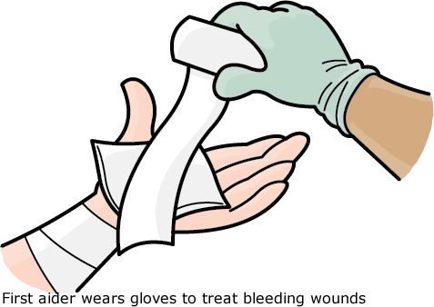 First aid bleeding
