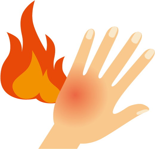 Burn Gout Skin Cartoon Hand - Quemaduras Png (625x624)