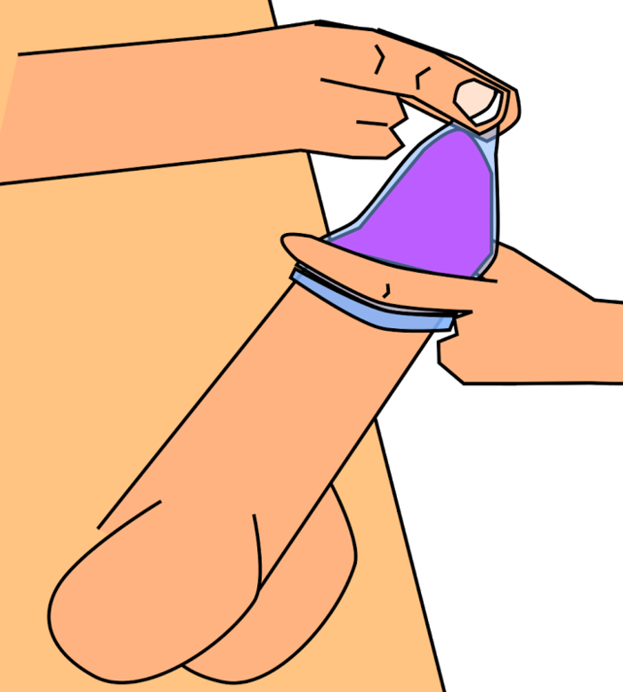 Kondom Abrollen - Scalable Vector Graphics (700x778)