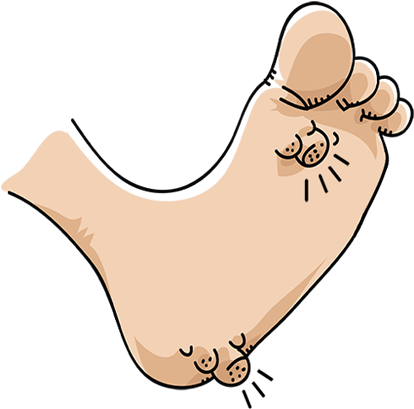 Warts - Wart Clipart (500x500)