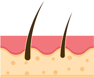 We Are A Specialized Medical Center For Dermatology - Organ (400x317)