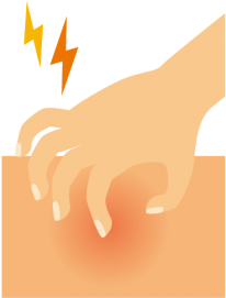 Mild Eczema , Chicken-pox, Sunburn, Insect Bites & - Pain (350x350)