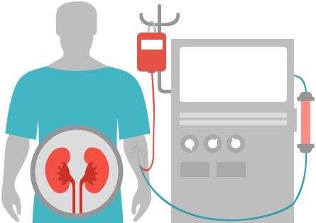 Chronic Kidney Failure - Chronic Kidney Disease Png (445x315)