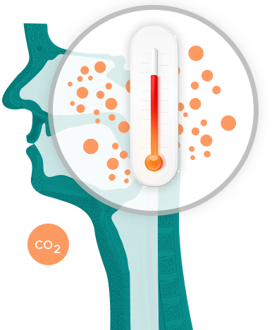 Co2 Levels In Your Throat Are Raised - Carbon Dioxide (386x468)