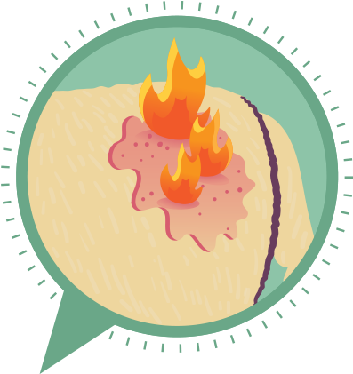 Dry Skin - Illustration (410x420)