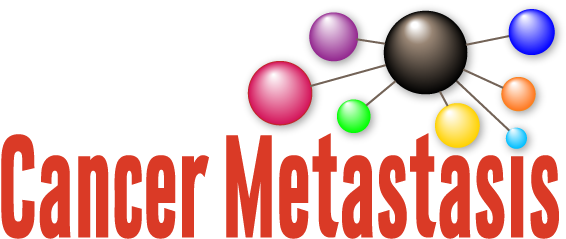 Support - Lymphovascular Invasion (596x246)