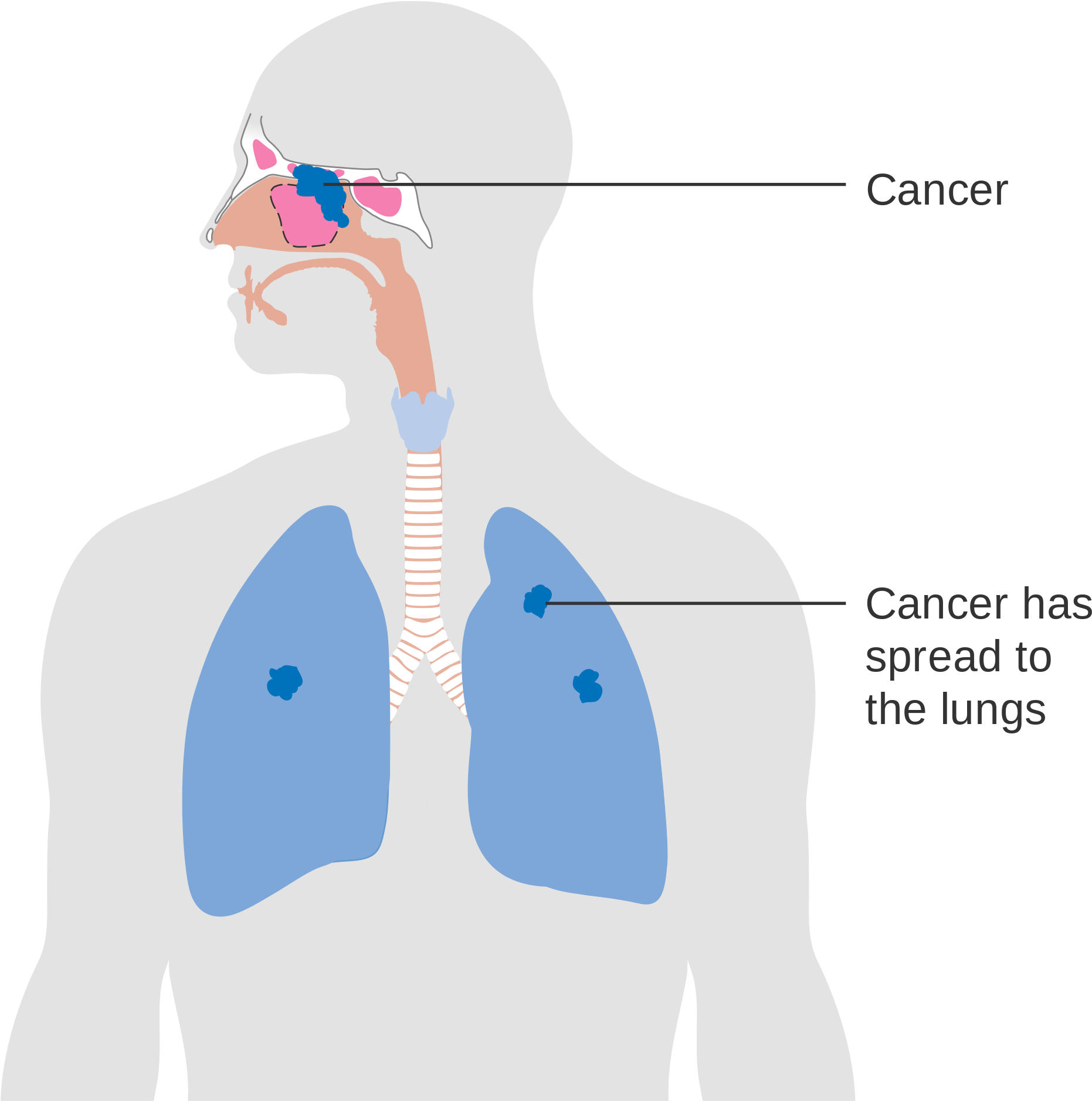 Open - Sinus In Lungs (2000x2053)