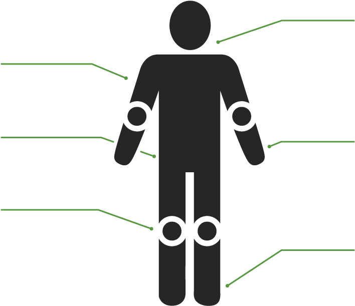Armac Inventory Management Bracing Products Image - Árbol Genealógico De La Fibrosis Quística (753x644)