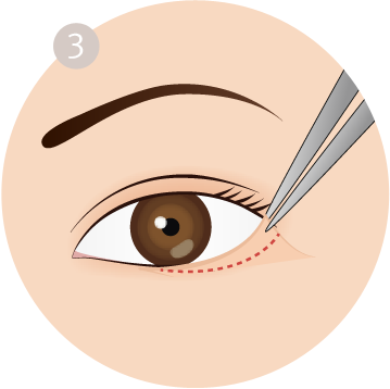 Onto The Periosteum On The Outer Side Of The Eyes - Circle (359x358)