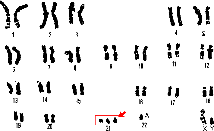 Inheritance Of Mitochondrial And Chloroplast Dna - Down Syndrome Scientific (1089x447)