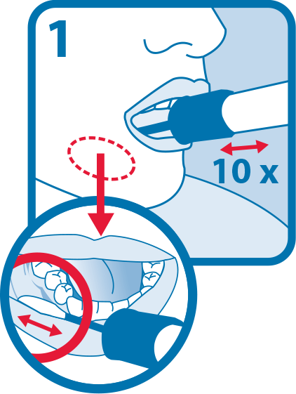 Open Package And Remove Collector Without Touching - Open Package And Remove Collector Without Touching (422x561)