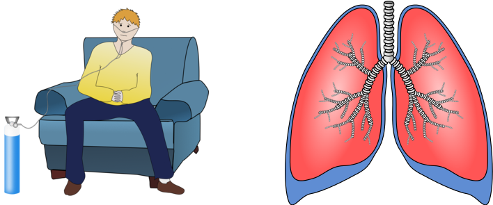 Copd Is A Chronic Condition Of The Lungs That Causes - Chronic Respiratory Disease Clipart (848x296)
