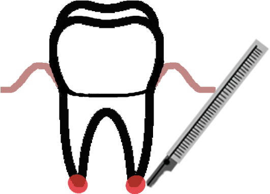 Dentoalveolar Surgery - Sketch (960x538)