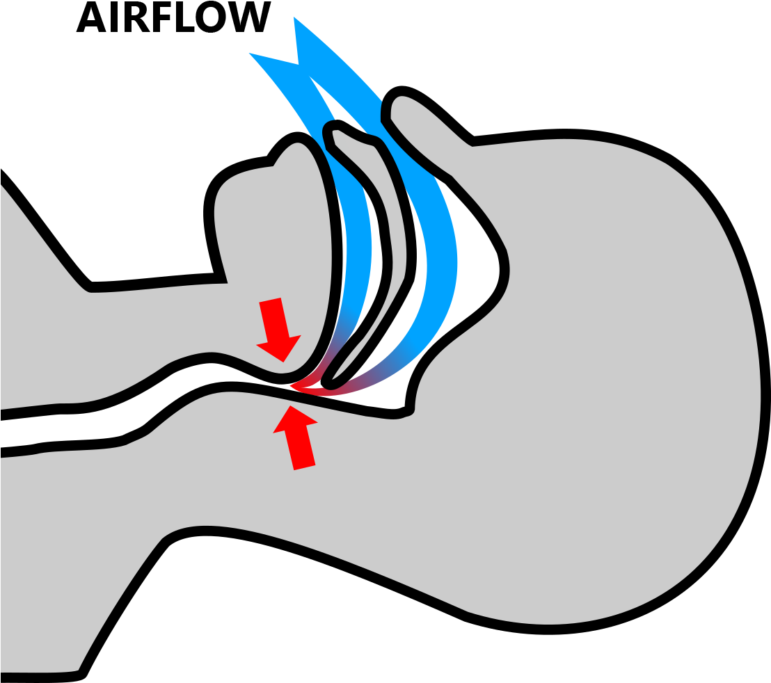 Without Snoremedic - Without Snoremedic (1107x1000)