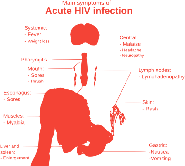 Hiv Aids Virus Symptoms (600x536)