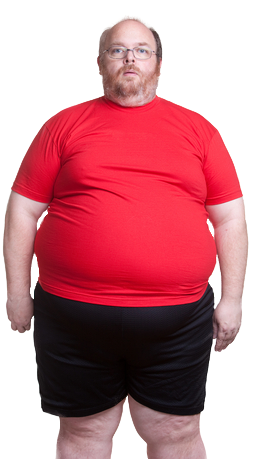 This Procedure Is For People Who Are Classified As - Fat Guy Red Shirt (278x458)