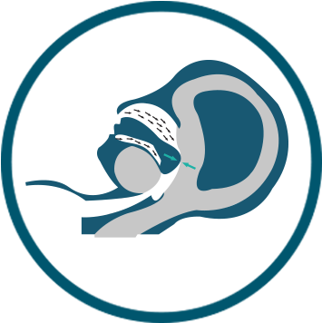 The Airway Collapses Repeatedly Throughout The Night - The Airway Collapses Repeatedly Throughout The Night (366x366)