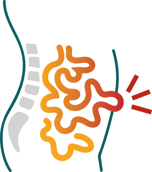 Hernia - Hernia (525x594)