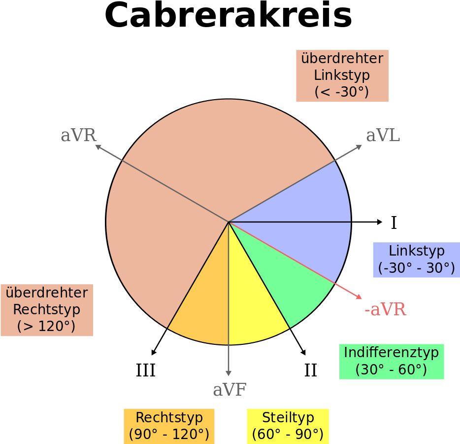 Open - Qrs Achse (1000x1000)