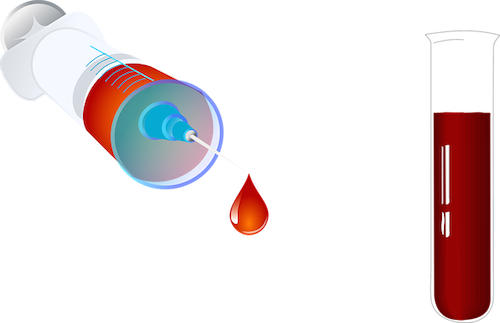 What Will A Blood Test Examine - Blood Test Tube Png (500x323)