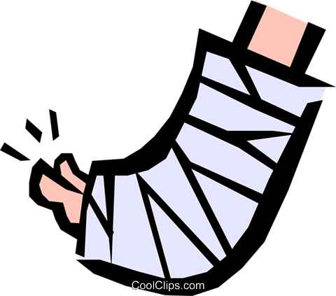 Cast On Foot Clip Art (480x423)
