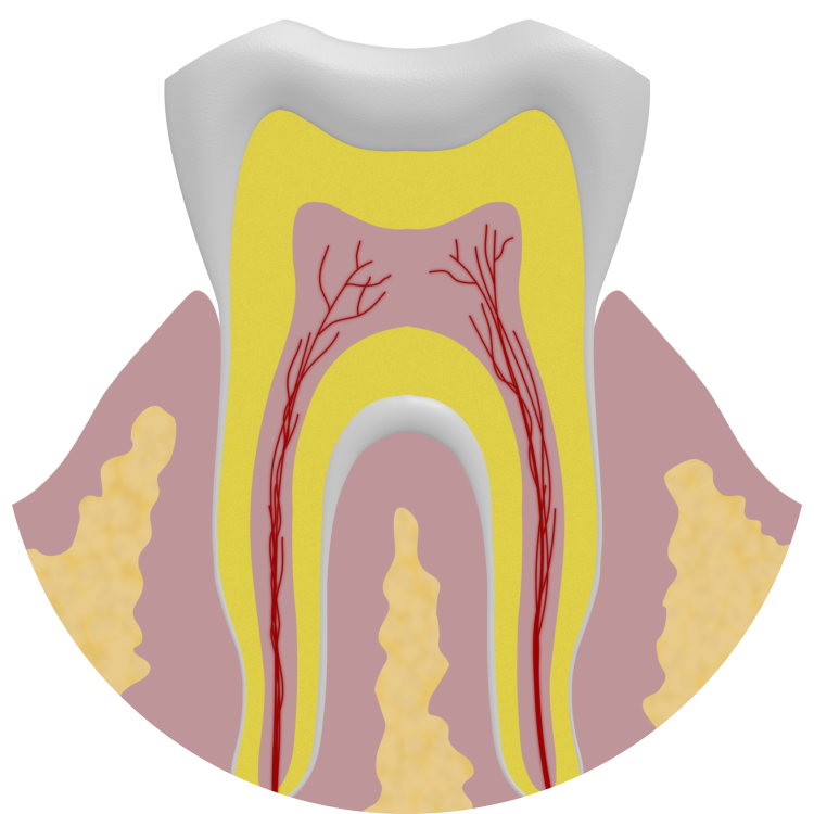 Object Stuck In Teeth - Illustration (750x750)