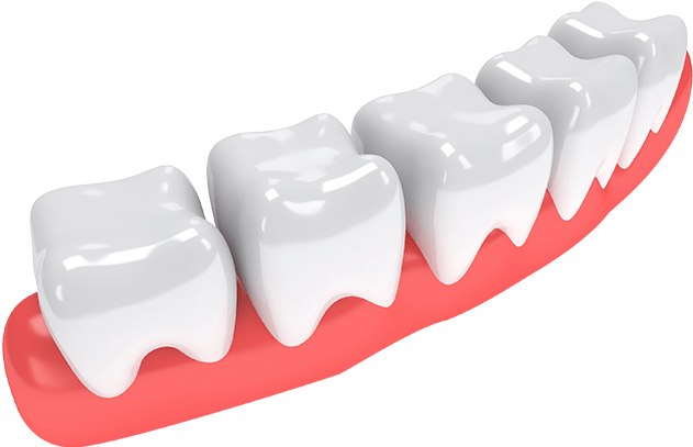 Why Did I Loss My Teeth - Gums (634x451)