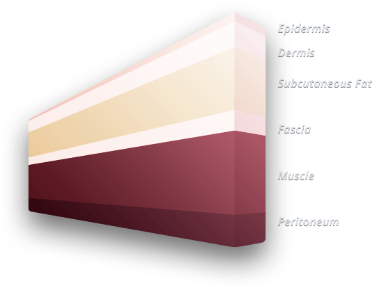 Surgical First Assistant Program Online - Plywood (613x461)