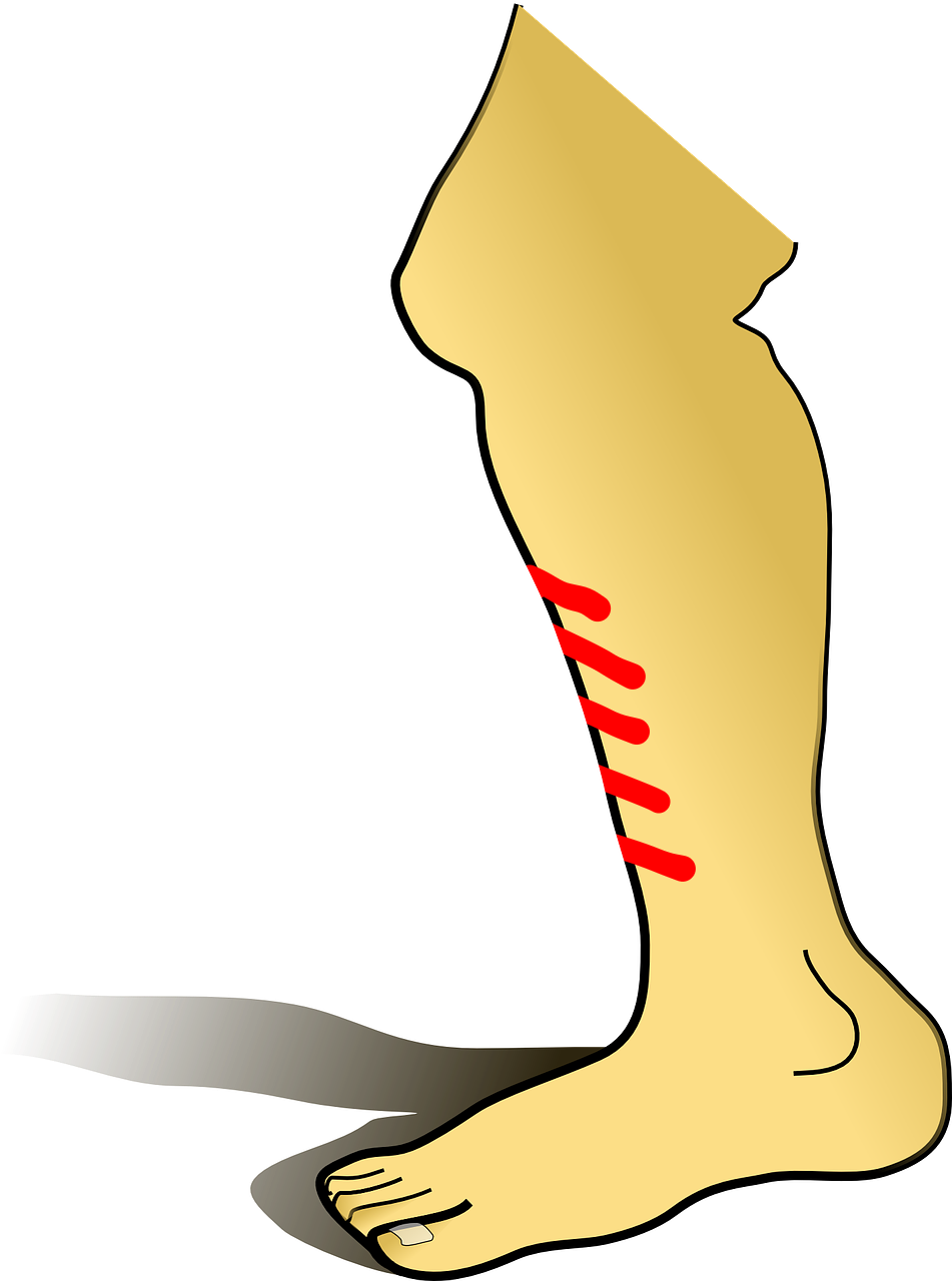 Importance Of Manganese - Leg Clip Art (1193x1280)