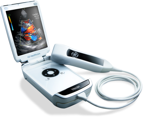 1 Product Picture Web - Ge Healthcare V-scan Ultrasound - Ge V-scan (650x480)