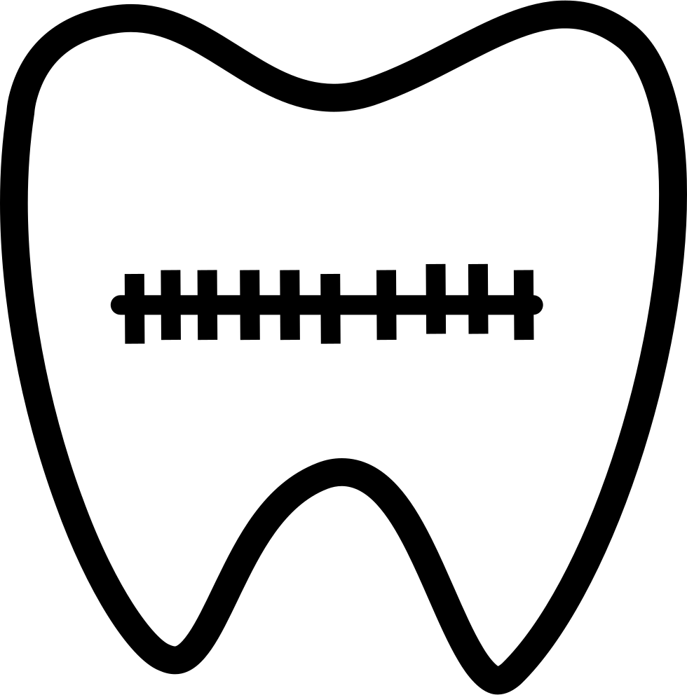 Tooth Correction Bracket Comments - Tooth (980x992)