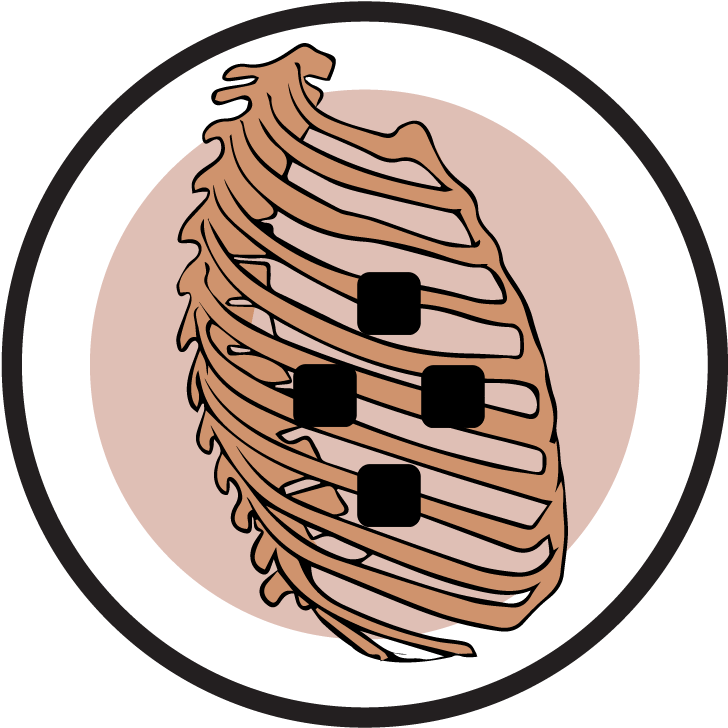 Rib Cage Pain Due To Degenerative Arthritis - Submarine Force Library And Museum (764x768)