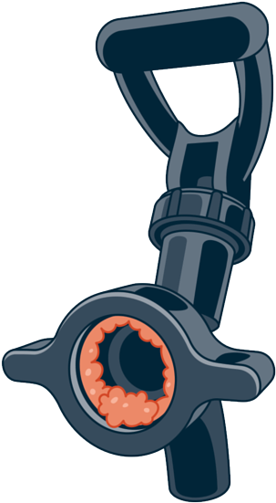 Eliminate Faucet Bacteria Buildup - Irrigation Sprinkler (399x600)