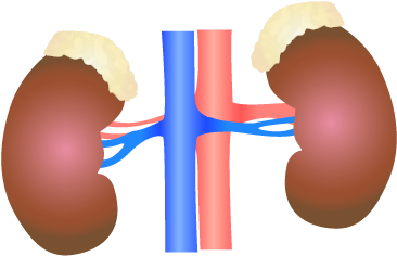 201405 Kidney - Polycystic Kidney Disease (400x400)