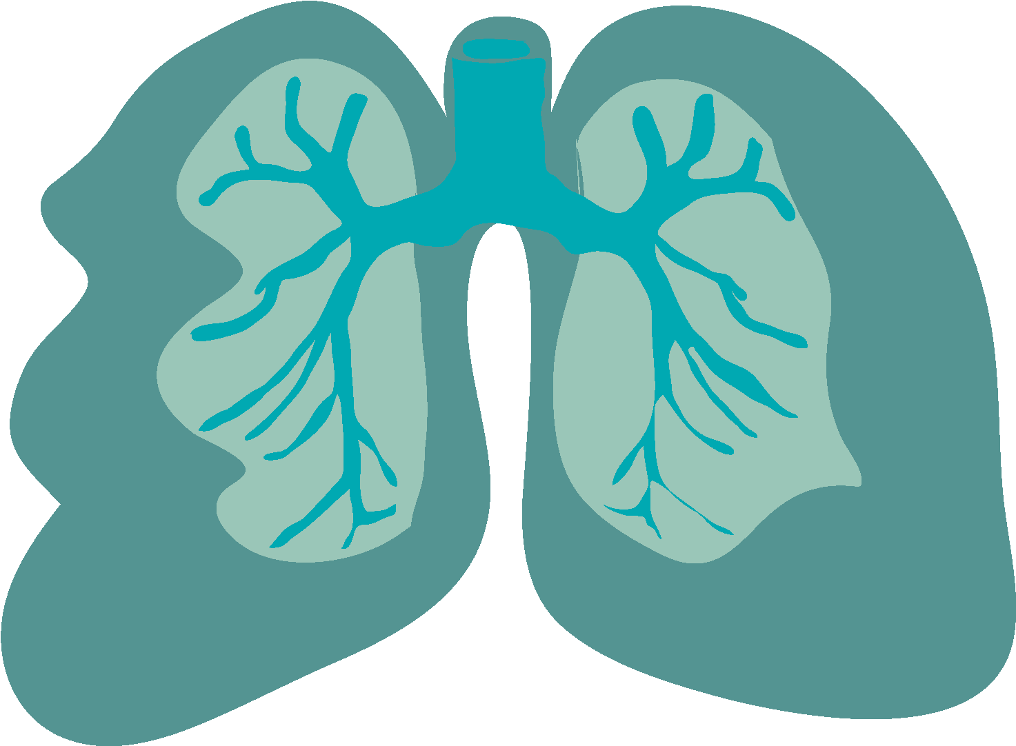 La Enfermedad Pulmonar Obstructiva Crónica Es Una Dificultad - Pulmon Epoc Png (1624x1087)