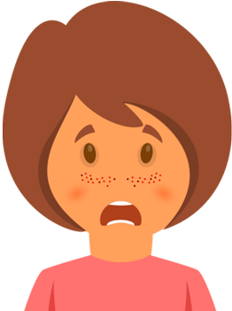 In Comparison To People My Age, My Skin Has Been Prone - Cartoon (350x350)