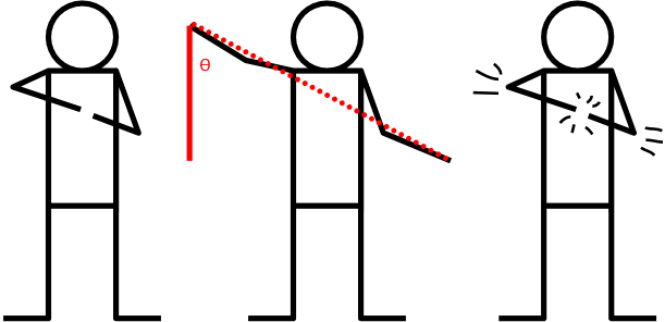 *the Problem With This Kind Of Activation Of The Slingshot - Diagram (611x296)