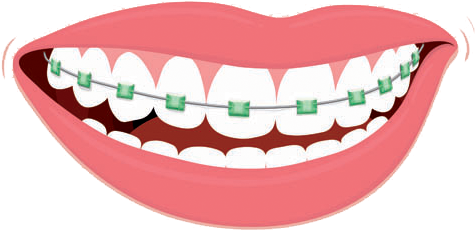 Color Me Braces - Dental Braces Clipart (600x231)