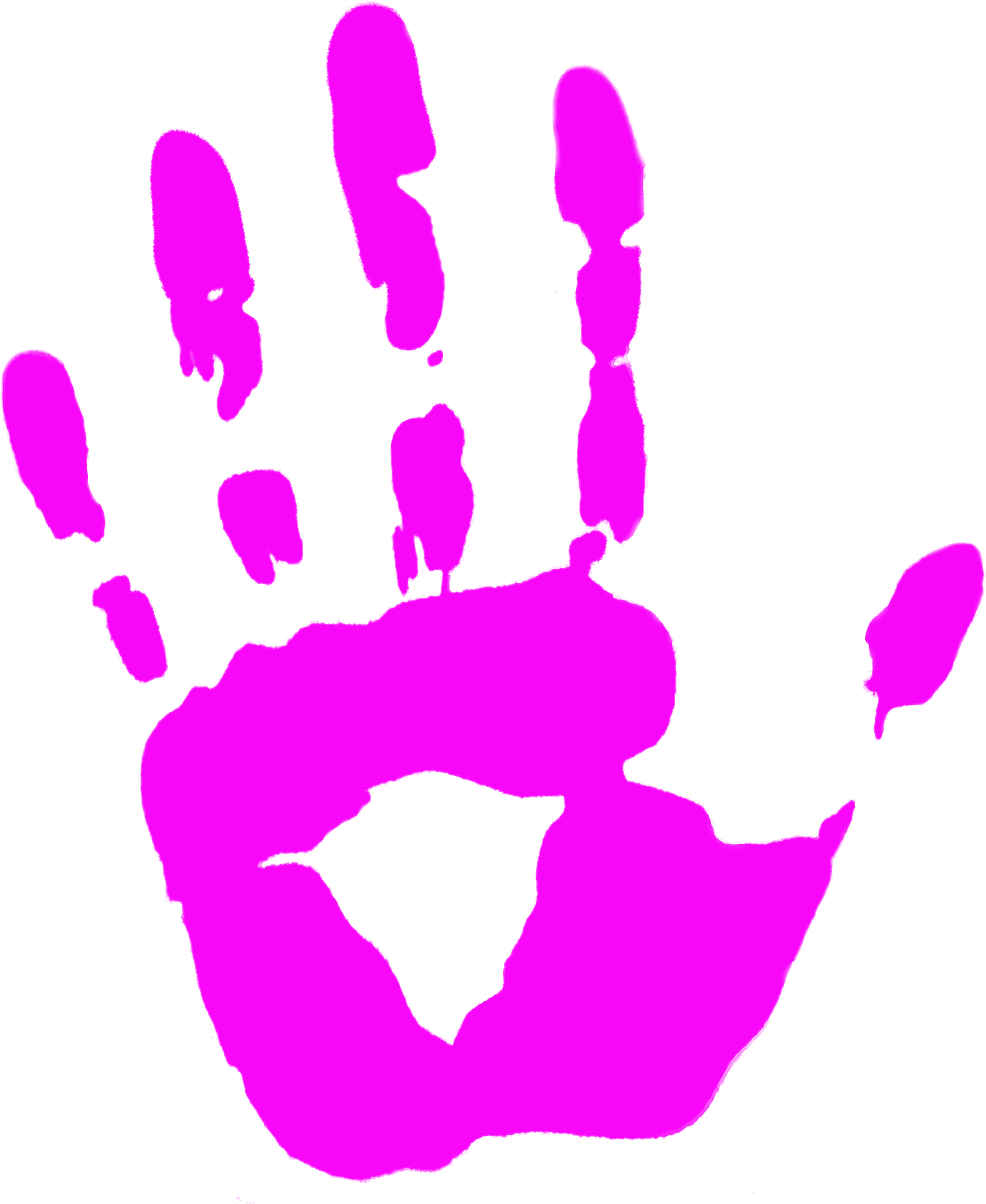 Sedation Dentist In Gibsonia, Pa - Pink Crown (2297x2706)