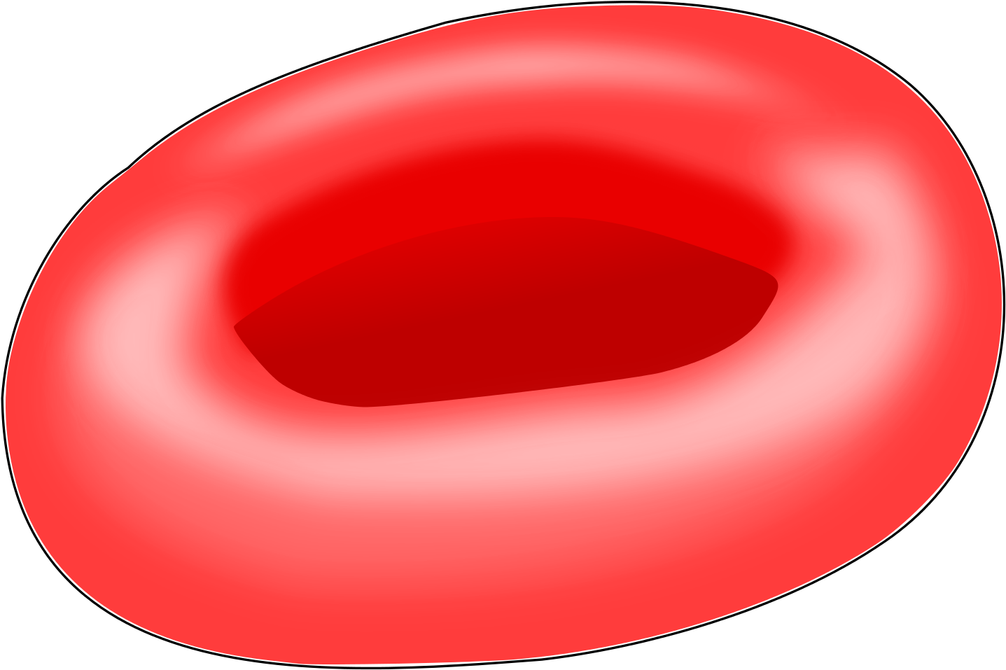 Red Blood Cell Sickle Cell Disease Hemoglobin - One Red Blood Cell (2000x1667)
